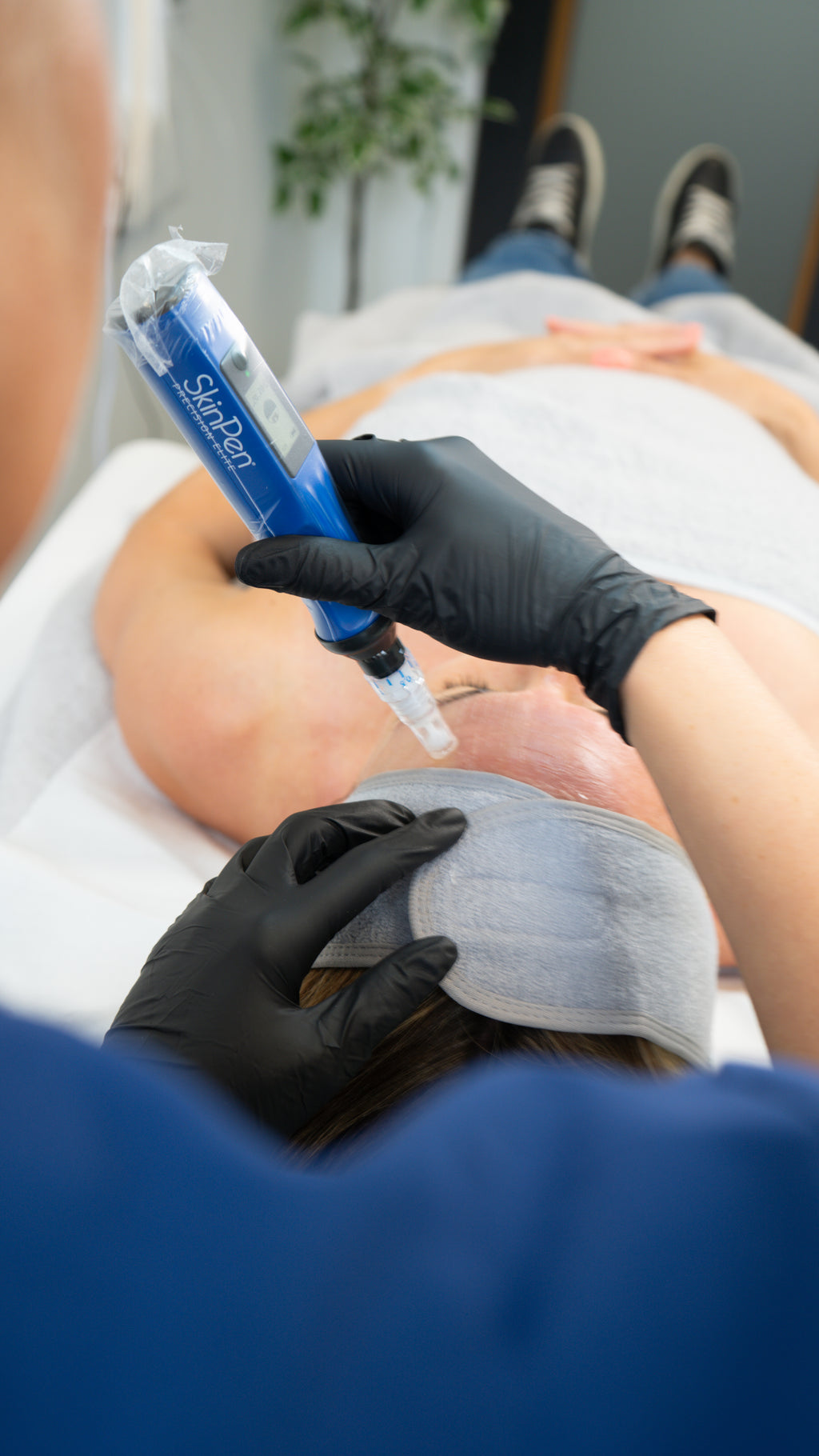 Microneedling